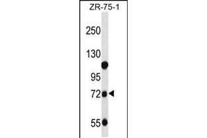 Western blot analysis in ZR-75-1 cell line lysates (35ug/lane). (Glucuronidase beta Antikörper  (C-Term))
