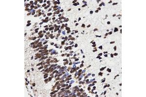 Immunohistochemistry (IHC) image for anti-High Mobility Group Box 1 (HMGB1) (AA 100-200) antibody (ABIN3023358) (HMGB1 Antikörper  (AA 100-200))
