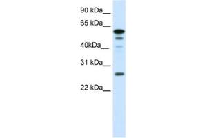 Western Blotting (WB) image for anti-Forkhead Box D1 (FOXD1) antibody (ABIN2461434)