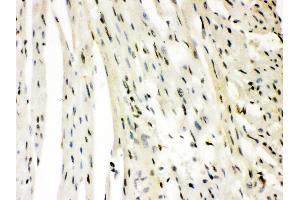 Anti- SLUG Picoband antibody,IHC(P) IHC(P): Rat Cardiac Muscle Tissue (SLUG Antikörper  (Middle Region))