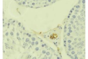 ABIN6273663 at 1/100 staining Mouse testis tissue by IHC-P. (IL1RL1 Antikörper  (Internal Region))