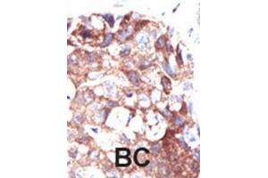Immunohistochemistry (IHC) image for anti-Ubiquilin 1 (UBQLN1) antibody (ABIN3001493) (Ubiquilin 1 Antikörper)