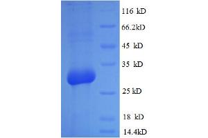 SDS-PAGE (SDS) image for Osteocalcin (BGLAP) (AA 50-99) protein (GST tag) (ABIN5709135)