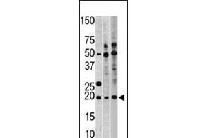 Western blot analysis of anti-RPL23A Pab in, from left to right, CEM, Hela, and HepG2 cell line lysates (35ug/lane) (RPL23A Antikörper  (C-Term))