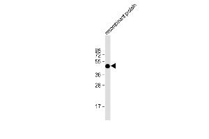 Anti-FAT1 Antibody at 1:2000 dilution + recombinant protein Lysates/proteins at 20 μg per lane. (FAT1 Antikörper  (AA 4203-4539))