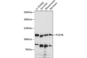 Western blot analysis of extracts of various cell lines, using PCDH8 antibody (ABIN7269731) at 1:1000 dilution. (Protocadherin 8 Antikörper  (AA 450-750))