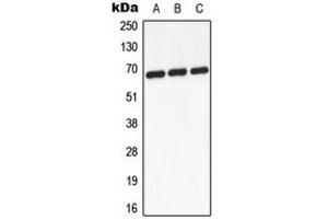 Western blot analysis of GCKR expression in A431 (A), mouse heart (B), PC12 (C) whole cell lysates. (GCKR Antikörper  (Center))