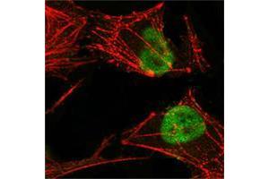 Confocal immunofluorescence analysis of Hela cells using MSH2 mouse mAb (green), showing nuclear localization. (MSH2 Antikörper)