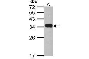 WB Image Sample (30 ug of whole cell lysate) A: Hela 12% SDS PAGE Protease Inhibitor 15 antibody antibody diluted at 1:1000