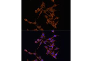 Immunofluorescence (IF) image for anti-Ubiquitin-Conjugating Enzyme E2, J1, U (UBE2J1) (AA 1-100) antibody (ABIN7271172)