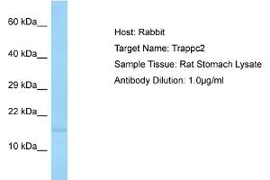 Host: Rabbit Target Name: TRAPPC2 Sample Tissue: Rat Stomach Antibody Dilution: 1ug/ml (TRAPPC2 Antikörper  (N-Term))