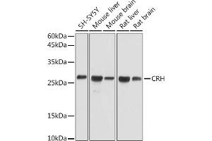 Western blot analysis of extracts of various cell lines, using CRH antibody (ABIN3021479, ABIN3021480, ABIN3021481 and ABIN6215115) at 1:1000 dilution. (CRH Antikörper  (AA 25-194))