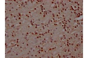 IHC image of ABIN7127607 diluted at 1:100 and staining in paraffin-embedded human brain tissue performed on a Leica BondTM system. (Rekombinanter MAD2L2 Antikörper)