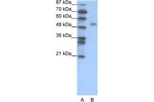 Human Jurkat; WB Suggested Anti-FOXD2 Antibody Titration: 1. (FOXD2 Antikörper  (N-Term))