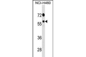 DDX19B Antibody (N-term) (ABIN1881254 and ABIN2838987) western blot analysis in NCI- cell line lysates (35 μg/lane). (DDX19B Antikörper  (N-Term))