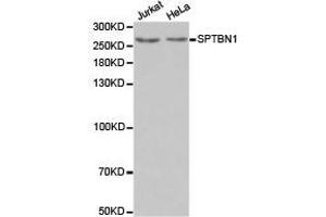 Western Blotting (WB) image for anti-Spectrin Beta, Non-Erythrocytic 1 (SPTBN1) antibody (ABIN1874930)