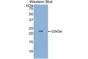 Western Blotting (WB) image for anti-Parkinson Protein 7 (PARK7) (AA 1-189) antibody (ABIN1078422) (PARK7/DJ1 Antikörper  (AA 1-189))