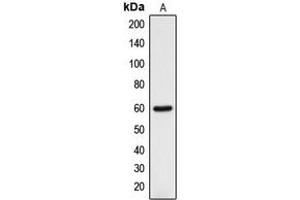 Western blot analysis of DCLRE1B expression in HOS (A) whole cell lysates. (DCLRE1B Antikörper  (C-Term))