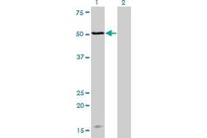 Western Blot analysis of MAGOH expression in transfected 293T cell line by MAGOH monoclonal antibody (M02), clone 4H8. (MAGOH Antikörper  (AA 1-110))