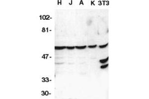 Image no. 1 for anti-Caspase 10, Apoptosis-Related Cysteine Peptidase (CASP10) (AA 505-521) antibody (ABIN201420) (Caspase 10 Antikörper  (AA 505-521))