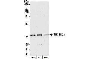 anti-TBC1 Domain Family, Member 23 (TBC1D23) (AA 525-575) antibody
