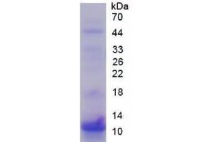 Image no. 1 for S100 Calcium Binding Protein P (S100P) (AA 1-95) protein (His tag) (ABIN1080774) (S100P Protein (AA 1-95) (His tag))