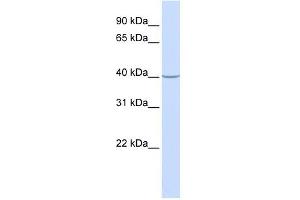 ACADS antibody used at 1 ug/ml to detect target protein. (ACADS Antikörper  (N-Term))