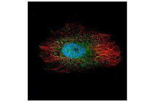 ICC/IF Image Confocal immunofluorescence analysis (Olympus FV10i) of paraformaldehyde-fixed HeLa, using LIM kinase 2, antibody (Green) at 1:500 dilution. (LIMK2 Antikörper)