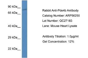 Western Blotting (WB) image for anti-phosphodiesterase 4B, cAMP-Specific (PDE4B) (N-Term) antibody (ABIN785795) (PDE4B Antikörper  (N-Term))