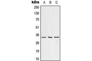 Western blot analysis of CD32c expression in HeLa (A), Raw264. (FCGR2C Antikörper  (C-Term))