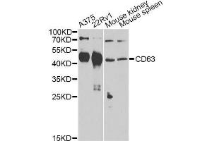 Western blot analysis of extracts of various cell lines, using CD63 Antibody. (CD63 Antikörper)