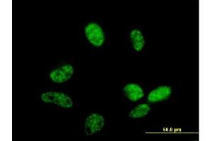 Immunofluorescence of purified MaxPab antibody to ZC3H14 on HeLa cell.