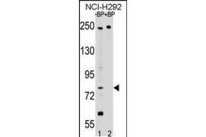 Western blot analysis of APPL2 Antibody Pab pre-incubated without(lane 1) and with(lane 2) blocking peptide in NCI-H292 cell line lysate. (APPL2 Antikörper  (N-Term))