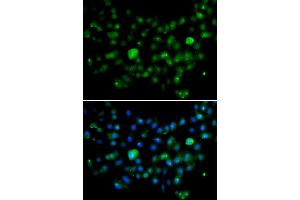Immunofluorescence analysis of A549 cell using MCM10 antibody. (MCM10 Antikörper)