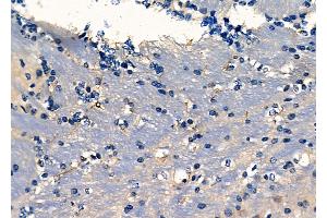 ABIN6261819 and ABIN6278083 at 1/100 staining Mouse brain tissue by IHC-P. (Fascin Antikörper  (C-Term))