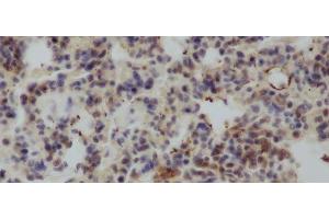 Immunohistochemistry of paraffin-embedded Rat lung using IL4 Polyclonal Antibody at dilution of 1:50 (IL-4 Antikörper)