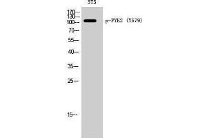 Western Blotting (WB) image for anti-PTK2B Protein tyrosine Kinase 2 beta (PTK2B) (pTyr579) antibody (ABIN3179709) (PTK2B Antikörper  (pTyr579))