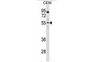 PAX7 Antibody (Center) western blot analysis in CEM cell line lysates (35µg/lane). (PAX7 Antikörper  (Middle Region))
