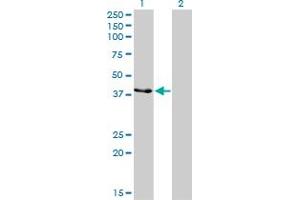 Western Blotting (WB) image for anti-Creatine Kinase, Mitochondrial 1B (CKMT1B) (AA 327-417) antibody (ABIN514430)