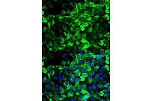 Immunofluorescence analysis of HeLa cell using TPM1 antibody. (Tropomyosin Antikörper  (AA 1-245))