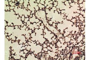Immunohistochemistry (IHC) image for anti-Nuclear Factor (erythroid-Derived 2)-Like 2 (NFE2L2) (acLys599) antibody (ABIN3188008)