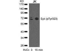 Western blot analysis of extracts from JK cells untreated or treated with H2O2 for the indicated times, using syk(phospho-Tyr323) Antibody.