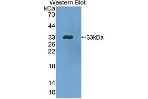 Western Blotting (WB) image for anti-Signal Transducer and Activator of Transcription 5B (STAT5B) (AA 497-749) antibody (ABIN3206169) (STAT5B Antikörper  (AA 497-749))