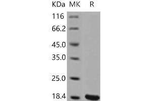 Western Blotting (WB) image for Interleukin 1, beta (IL1B) (Active) protein (ABIN7321252) (IL-1 beta Protein)