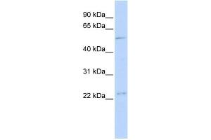 WB Suggested Anti-TFDP1 Antibody Titration:  0.