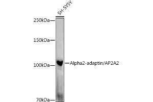Western blot analysis of extracts of SH-SY5Y cells, using Alph-adaptin/ antibody (ABIN6130980, ABIN6136955, ABIN6136957 and ABIN6221039) at 1:1000 dilution. (AP2A2 Antikörper  (AA 590-939))