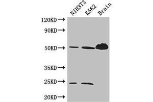 Western Blot Positive WB detected in: NIH/3T3 whole cell lysate, K562 whole cell lysate, Mouse brain tissue All lanes: TUBA4A antibody at 3 μg/mL Secondary Goat polyclonal to rabbit IgG at 1/50000 dilution Predicted band size: 50, 49 kDa Observed band size: 50, 24 kDa (TUBA4A Antikörper  (AA 20-183))