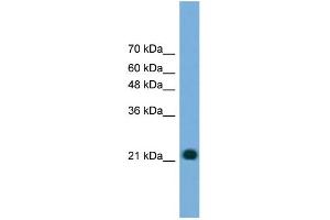 WB Suggested Anti-MYL4 Antibody Titration: 0. (MYL4 Antikörper  (N-Term))