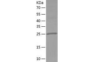 Western Blotting (WB) image for Pyrophosphatase (Inorganic) 1 (PPA1) (AA 1-289) protein (His tag) (ABIN7124715)