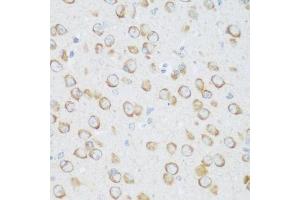 Immunohistochemistry of paraffin-embedded mouse brain using DHODH antibody. (DHODH Antikörper  (AA 116-395))
